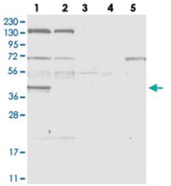 SDCCAG3, Rabbit, Polyclonal Antibody, Abnova 100 &mu;L | Buy Online | Abnova Corporation | Fisher Scientific