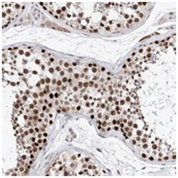 SNRNP200, Rabbit, Polyclonal Antibody, Abnova 100&mu;L; Unlabeled:Antibodies,