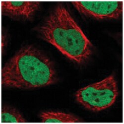 SNRNP200, Rabbit, Polyclonal Antibody, Abnova 100&mu;L; Unlabeled:Antibodies,