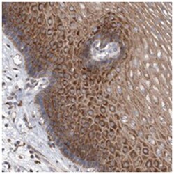 SMG7 Rabbit anti-Human, Polyclonal Antibody, Abnova 100&mu;L; Unlabeled:Antibodies,