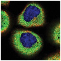 SMG7 Rabbit anti-Human, Polyclonal Antibody, Abnova 100&mu;L; Unlabeled:Antibodies,