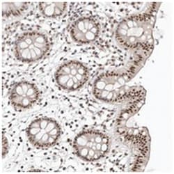 KIAA0240 Rabbit anti-Human, Polyclonal Antibody, Abnova 100 &mu;L | Buy Online | Abnova Corporation | Fisher Scientific
