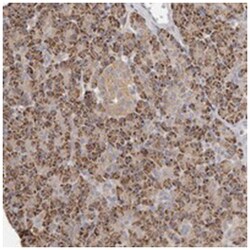 C21orf56 Rabbit anti-Human, Polyclonal Antibody, Abnova 100 &mu;L | Buy Online | Abnova Corporation | Fisher Scientific