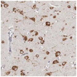 FAM167B, Rabbit, Polyclonal Antibody, Abnova 100&mu;L; Unlabeled:Antibodies,