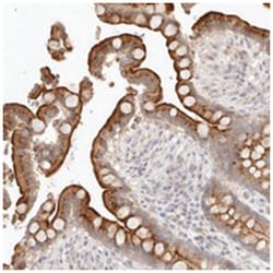 MEP1A, Rabbit, Polyclonal Antibody, Abnova 100&mu;L; Unlabeled:Antibodies,