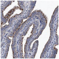CHRNA3, Rabbit, Polyclonal Antibody, Abnova 100&mu;L; Unlabeled:Antibodies,