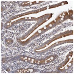 C7orf43 Rabbit anti-Human, Polyclonal Antibody, Abnova 100 &mu;L | Buy Online | Abnova Corporation | Fisher Scientific