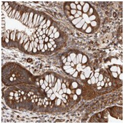 TMC7, Rabbit, Polyclonal Antibody, Abnova 100 &mu;L | Buy Online | Abnova Corporation | Fisher Scientific