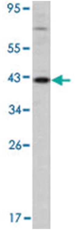 Dnmt3l, Rabbit, Polyclonal Antibody, Abnova 400 &mu;L | Buy Online | Abnova Corporation | Fisher Scientific