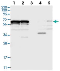 ZNF655, Rabbit, Polyclonal Antibody, Abnova 100 &mu;L | Buy Online | Abnova Corporation | Fisher Scientific