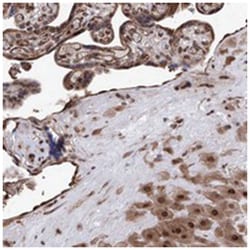 ZNF655, Rabbit, Polyclonal Antibody, Abnova 100 &mu;L | Buy Online | Abnova Corporation | Fisher Scientific