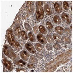 RANBP17 Rabbit anti-Human, Polyclonal Antibody, Abnova 100 &mu;L | Buy Online | Abnova Corporation | Fisher Scientific