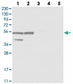 HGSNAT, Rabbit, Polyclonal Antibody, Abnova 100 &mu;L | Buy Online | Abnova Corporation | Fisher Scientific