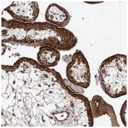 HGSNAT, Rabbit, Polyclonal Antibody, Abnova 100 &mu;L | Buy Online | Abnova Corporation | Fisher Scientific