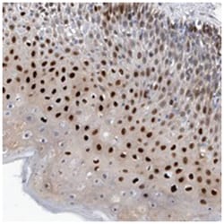 PHF20 Rabbit anti-Human, Polyclonal Antibody, Abnova 100 &mu;L | Buy Online | Abnova Corporation | Fisher Scientific