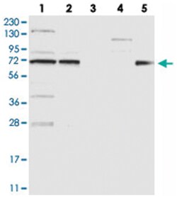 AIM1L Rabbit anti-Human, Polyclonal Antibody, Abnova 100&mu;L; Unlabeled:Antibodies,