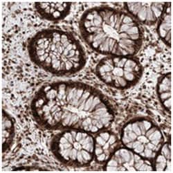 AIM1L Rabbit anti-Human, Polyclonal Antibody, Abnova 100 &mu;L | Buy Online | Abnova Corporation | Fisher Scientific