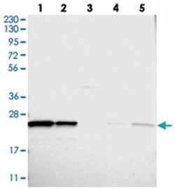 PSMB1 Rabbit anti-Human, Mouse, Rat, Polyclonal Antibody, Abnova 100 &mu;L | Buy Online | Abnova Corporation | Fisher Scientific