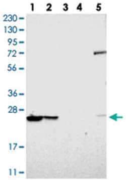 PSMB1 Rabbit anti-Human, Mouse, Rat, Polyclonal Antibody, Abnova 100 &mu;L | Buy Online | Abnova Corporation | Fisher Scientific