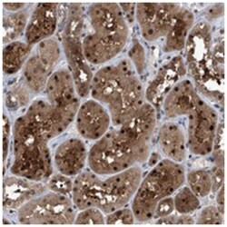 PSMB1 Rabbit anti-Human, Mouse, Rat, Polyclonal Antibody, Abnova 100 &mu;L | Buy Online | Abnova Corporation | Fisher Scientific