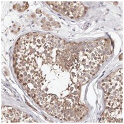 TYW3 Rabbit anti-Human, Polyclonal Antibody, Abnova 100 &mu;L | Buy Online | Abnova Corporation | Fisher Scientific