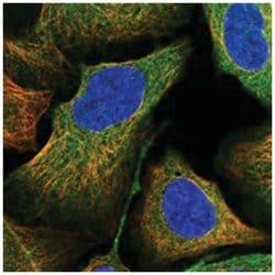 ANKRD34A Rabbit anti-Human, Mouse, Rat, Polyclonal Antibody, Abnova 100 &mu;L | Buy Online | Abnova Corporation | Fisher Scientific