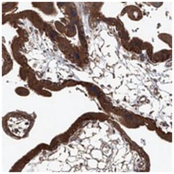 ANKRD34A Rabbit anti-Human, Polyclonal Antibody, Abnova 100&mu;L; Unlabeled:Antibodies,