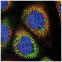 ANKRD34A Rabbit anti-Human, Polyclonal Antibody, Abnova 100&mu;L; Unlabeled:Antibodies,