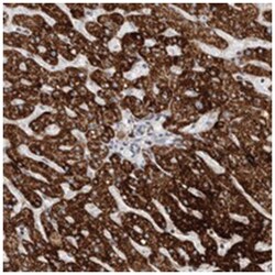 C17orf99, Rabbit, Polyclonal Antibody, Abnova 100&mu;L; Unlabeled:Antibodies,