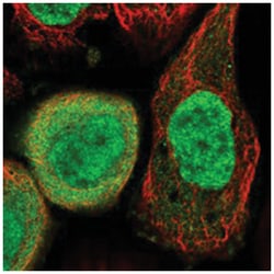 C6orf108 Rabbit anti-Human, Polyclonal Antibody, Abnova 100&mu;L; Unlabeled:Antibodies,