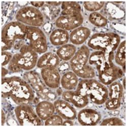 C6orf108 Rabbit anti-Human, Polyclonal Antibody, Abnova 100&mu;L; Unlabeled:Antibodies,