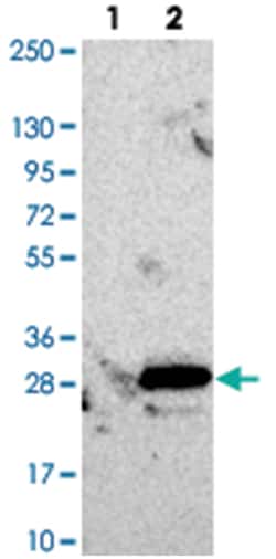 C6orf108 Rabbit anti-Human, Polyclonal Antibody, Abnova 100&mu;L; Unlabeled:Antibodies,