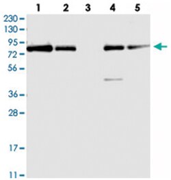 APEH Rabbit anti-Human, Rat, Polyclonal Antibody, Abnova 100 &mu;L | Buy Online | Abnova Corporation | Fisher Scientific