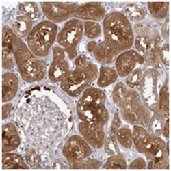 APEH Rabbit anti-Human, Rat, Polyclonal Antibody, Abnova 100 &mu;L | Buy Online | Abnova Corporation | Fisher Scientific