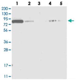 APEH Rabbit anti-Human, Polyclonal Antibody, Abnova 100 &mu;L | Buy Online | Abnova Corporation | Fisher Scientific