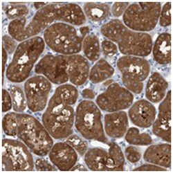 APEH Rabbit anti-Human, Polyclonal Antibody, Abnova 100 &mu;L | Buy Online | Abnova Corporation | Fisher Scientific