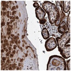 SLC18B1, Rabbit, Polyclonal Antibody, Abnova 100 &mu;L | Buy Online | Abnova Corporation | Fisher Scientific