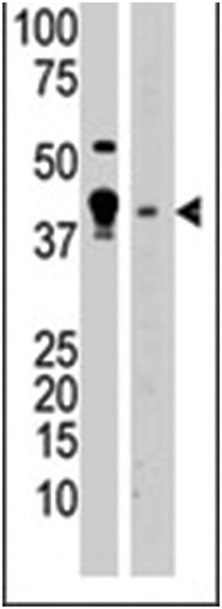 MBD2 Rabbit anti-Human, Mouse, Polyclonal Antibody, Abnova 400&mu;L; Unlabeled:Antibodies,