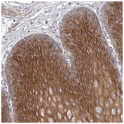 GPSN2, Rabbit, Polyclonal Antibody, Abnova 100&mu;L; Unlabeled:Antibodies,