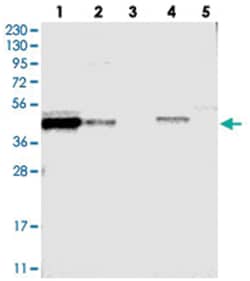 FAM54A Rabbit anti-Human, Polyclonal Antibody, Abnova 100 &mu;L | Buy Online | Abnova Corporation | Fisher Scientific