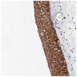 TTC24 Rabbit anti-Human, Polyclonal Antibody, Abnova 100&mu;L; Unlabeled:Antibodies,