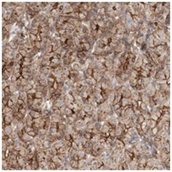C14orf94, Rabbit, Polyclonal Antibody, Abnova 100 &mu;L | Buy Online | Abnova Corporation | Fisher Scientific
