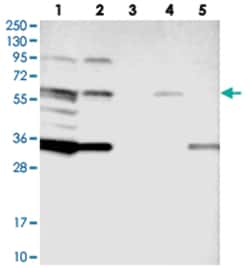 TTI2 Rabbit anti-Human, Polyclonal Antibody, Abnova 100 &mu;L | Buy Online | Abnova Corporation | Fisher Scientific