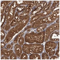 TTI2 Rabbit anti-Human, Polyclonal Antibody, Abnova 100 &mu;L | Buy Online | Abnova Corporation | Fisher Scientific