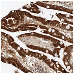 ATXN7L2, Rabbit, Polyclonal Antibody, Abnova 100&mu;L; Unlabeled:Antibodies,