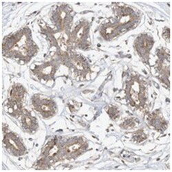 CAGE1, Rabbit, Polyclonal Antibody, Abnova 100&mu;L; Unlabeled:Antibodies,