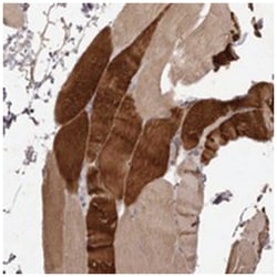 PNRC1, Rabbit, Polyclonal Antibody, Abnova 100 &mu;L | Buy Online | Abnova Corporation | Fisher Scientific