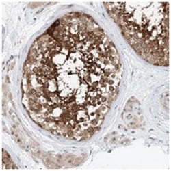 CLDND1 Rabbit anti-Human, Polyclonal Antibody, Abnova 100 &mu;L | Buy Online | Abnova Corporation | Fisher Scientific