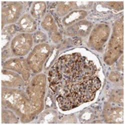 SLC22A1 Rabbit anti-Human, Polyclonal Antibody, Abnova 100 &mu;L | Buy Online | Abnova Corporation | Fisher Scientific