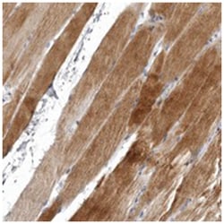 NKAIN4, Rabbit, Polyclonal Antibody, Abnova 100&mu;L; Unlabeled:Antibodies,